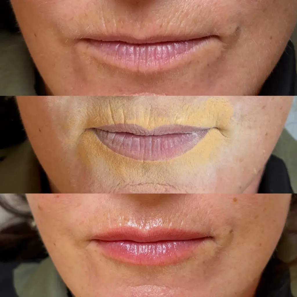 Lip blush before and after by Bea Pereira, Bristol