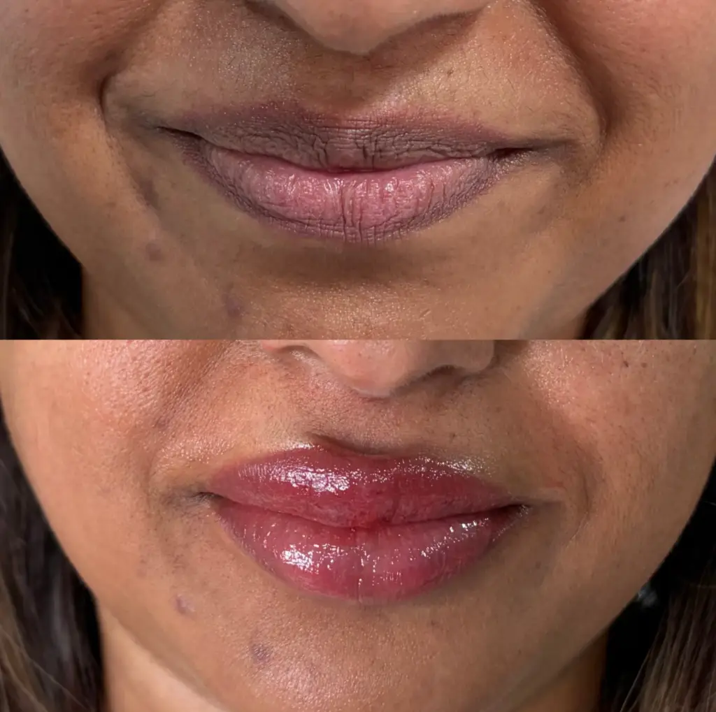 Lip neutralisation evening out lip tone by Bea Pereira, Bristol